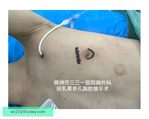 坎宁安气胸康复持续推进 活塞计划一周后复查评估